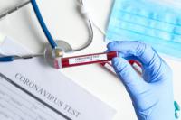 Test sierologici gratuiti per privati cittadini e lavoratori