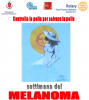 melanoma